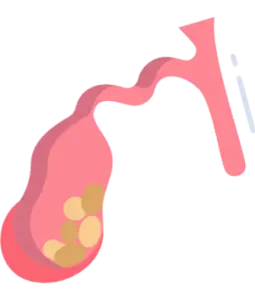 Gallbladder Surgery